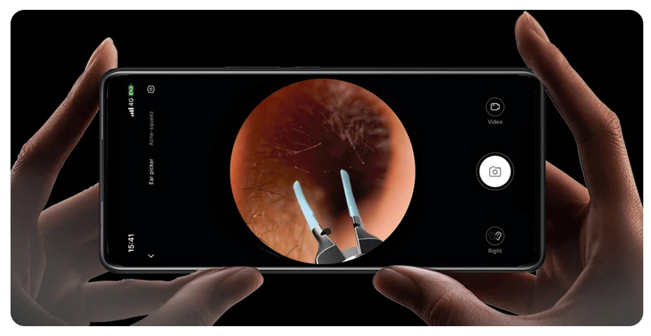 BEBIRD NOTE5 PRO OTOSCOPIO CON CAMARA PARA DEPILACION BLANCO