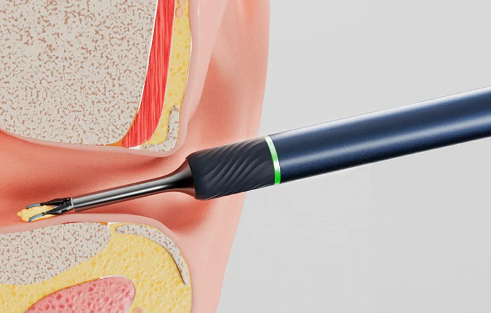 BEBIRD NOTE5 PRO OTOSCOPIO CON CAMARA DEPILADORA AZUL